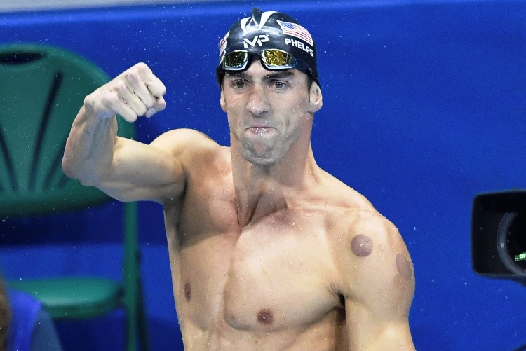 Michael Phelps Rio 2016 Chinese Cupping Therapy