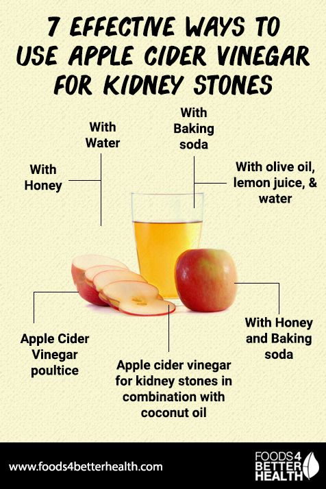 Apple Cider Vinegar For Kidney Stones